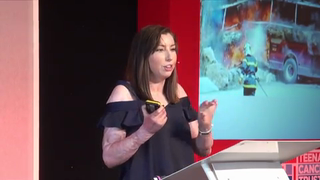 FYSOT Under 18s 2017 -96% Burns : Survivor to Thriver